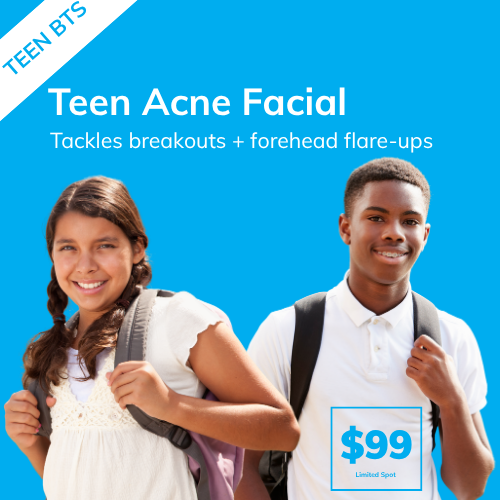 Teen Acne Facial